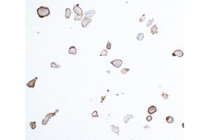 Immunocytochemistry (ICC) image for anti-Platelet Derived Growth Factor Receptor beta (PDGFRB) (AA 33-532) antibody (ABIN7453377) (Recombinant PDGFRB 抗体  (AA 33-532))