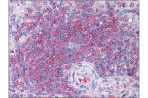 Immunohistochemistry (IHC) image for anti-5-Aminoimidazole-4-Carboxamide Ribonucleotide Formyltransferase/IMP Cyclohydrolase (ATIC) antibody (ABIN264511) (ATIC 抗体)