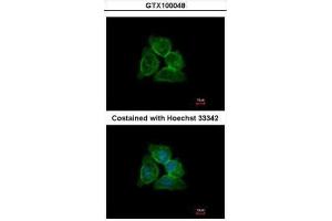ICC/IF Image Immunofluorescence analysis of methanol-fixed A431, using Annexin A13, antibody at 1:500 dilution. (Annexin A13 抗体  (N-Term))