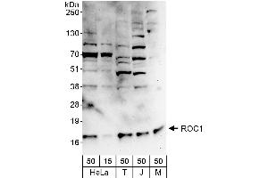 Western Blotting (WB) image for anti-ROC1 (AA 1-50) antibody (ABIN7454558) (ROC1 抗体  (AA 1-50))