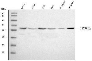Western blot analysis of TROVE2/SS-A/RO60 using anti-TROVE2/SS-A/RO60 antibody (ABIN7602595).