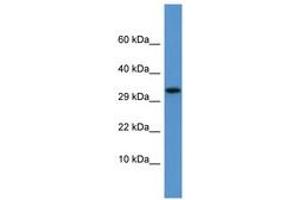 Image no. 1 for anti-Apolipoprotein F (APOF) (AA 175-224) antibody (ABIN6746096) (Apolipoprotein F 抗体  (AA 175-224))