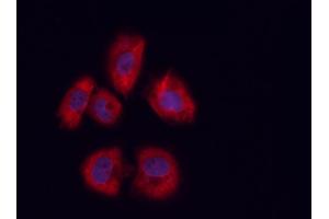 ABIN6258949 and ABIN6273453 staining U-2 OS cells by ICC/IF. (CD81 抗体  (Internal Region))