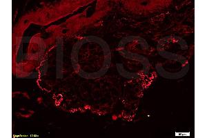 Formalin-fixed and rat pancreas tissue labeled with Anti-FN/Fibronectin 1 Polyclonal Antibody, Unconjugated (ABIN671646) at 1:200 followed by conjugation to the secondary antibody, Goat Anti-Rabbit IgG, PE conjugated (Fibronectin 抗体  (AA 1201-1300))