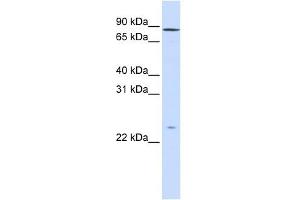 GPSM2 antibody used at 1 ug/ml to detect target protein. (GPSM2 抗体)