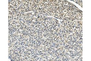 IHC analysis of AKR1D1 using anti-AKR1D1 antibody (ABIN7602975).
