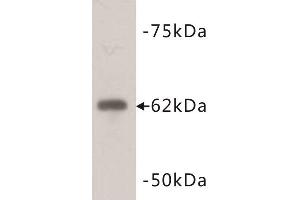 Western Blotting (WB) image for anti-PiggyBac Transposable Element Derived 5 (PGBD5) antibody (ABIN1854961) (PGBD5 抗体)