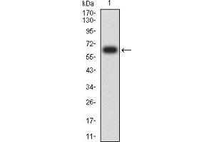 Western blot analysis using CD334 mAb against human CD334 (AA: extra 22-369) recombinant protein. (FGFR4 抗体  (AA 22-369))
