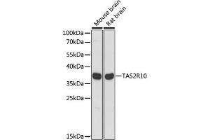 Western blot analysis of extracts of various cell lines, using TR10 antibody (ABIN7270735) at 1:1000 dilution. (TAS2R10 抗体  (AA 100-200))