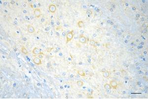 Immunohistochemistry was performed on paraffin-embedded mouse brain using ELP4 antibody (ABIN7798433), 1:200).