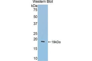 Western blot analysis of the recombinant protein. (LCAT 抗体  (AA 290-432))