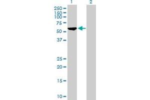 Western Blot analysis of CEP57 expression in transfected 293T cell line by CEP57 MaxPab polyclonal antibody. (CEP57 抗体  (AA 1-500))