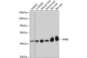 Western blot analysis of extracts of various cell lines using THRB Polyclonal Antibody at dilution of 1:1000. (THRB 抗体)