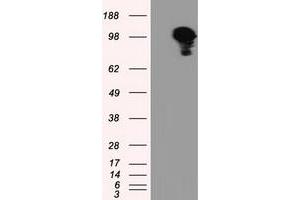 Image no. 3 for anti-Transforming, Acidic Coiled-Coil Containing Protein 3 (TACC3) antibody (ABIN1498099) (TACC3 抗体)