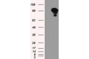 Image no. 3 for anti-Transforming, Acidic Coiled-Coil Containing Protein 3 (TACC3) antibody (ABIN1498099) (TACC3 抗体)