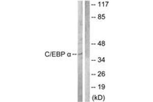 Western blot analysis of extracts from COS7 cells, treated with EGF 200ng/ml 30', using C/EBP-alpha (Ab-222) Antibody. (CEBPA 抗体  (AA 192-241))
