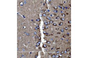 IHC analysis of PAK3 using anti-PAK3 antibody (ABIN7599182).