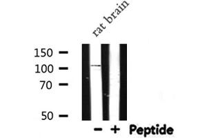 Western blot analysis of NOD1 expression in Rat brain lysate (NOD1 抗体  (C-Term))