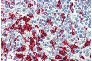 Human Spleen (formalin-fixed, paraffin-embedded) stained with HMOX1 antibody ABIN462095 at 10 ug/ml followed by biotinylated anti-mouse IgG secondary antibody ABIN481714, alkaline phosphatase-streptavidin and chromogen.