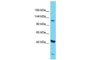 Host:  Rabbit  Target Name:  Zfp445  Sample Type:  Mouse Testis lysates  Antibody Dilution:  1. (ZNF445 抗体  (Middle Region))