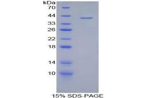 SDS-PAGE analysis of Human Corin Protein. (Corin 蛋白)