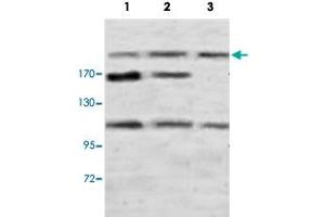 Western blot analysis of rat brain (Lane 1), rat testis (Lane 2) and human fetal kidney (Lane 3) lysate with PLXNB1 polyclonal antibody  at 1 : 500 dilution. (PLXNB1 抗体  (N-Term))