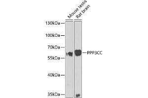 Western blot analysis of extracts of various cell lines, using PPP3CC antibody (ABIN6131416, ABIN6146099, ABIN6146100 and ABIN6223644) at 1:1000 dilution. (PPP3CC 抗体  (AA 373-512))
