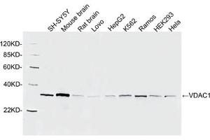 Western blot analysis of cell and tissue lysates using 1 µg/mL Rabbit Anti-VDAC1 Polyclonal Antibody (ABIN398895) The signal was developed with IRDyeTM 800 Conjugated Goat Anti-Rabbit IgG. (VDAC1 抗体  (AA 150-200))