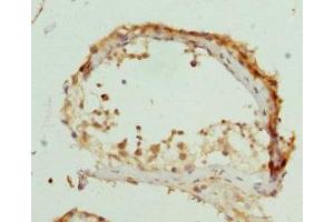 Immunohistochemistry of paraffin-embedded human testis tissue using ABIN7162541 at dilution of 1:100 (ZDHHC17 抗体  (AA 170-310))