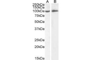 ABIN5539625 (2µg/ml) staining of HeLa (A) and Daudi (B) cell lysate (35µg protein in RIPA buffer). (ICAM1 抗体  (Internal Region))
