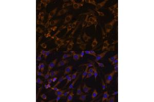 Immunofluorescence analysis of C6 cells using EIF5B antibody (ABIN7267052) at dilution of 1:100.