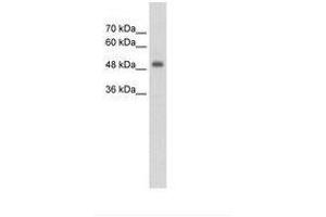 Image no. 1 for anti-CUE Domain Containing 1 (CUEDC1) (AA 251-300) antibody (ABIN203464) (CUEDC1 抗体  (AA 251-300))