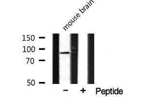 Western blot analysis of extracts from mouse brain, using CAGE1 antibody. (CAGE1 抗体  (C-Term))