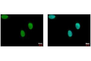 ICC/IF Image FANCJ antibody [N1N2], N-term detects BRIP1 protein at cytoplasm by immunofluorescent analysis.