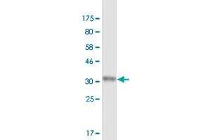 Western Blot detection against Immunogen (35. (RARRES1 抗体  (AA 205-294))