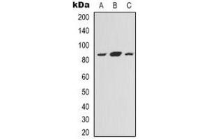 Western blot analysis of NOXIN expression in HEK293T (A), Hela (B), HepG2 (C) whole cell lysates. (C11orf82 抗体)