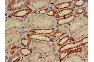 IHC image of ABIN7151274 diluted at 1:600 and staining in paraffin-embedded human kidney tissue performed on a Leica BondTM system. (TRIM39 抗体  (AA 310-416))