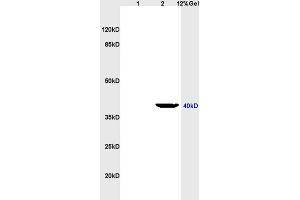 Lane 1: rat heart lysates Lane 2: rat brain lysates probed with Anti LTB4-R2 Polyclonal Antibody, Unconjugated (ABIN748643) at 1:200 in 4 °C. (LTB4R2 抗体  (AA 25-120))