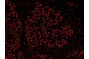 Immunofluorescence (IF) image for anti-Histone Deacetylase 2 (HDAC2) (C-Term) antibody (ABIN7448973) (HDAC2 抗体  (C-Term))