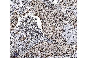 IHC analysis of PRDM14 using anti-PRDM14 antibody (ABIN7603152).