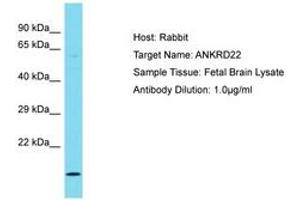 Image no. 1 for anti-Ankyrin Repeat Domain 22 (ANKRD22) (AA 48-97) antibody (ABIN6750744) (ANKRD22 抗体  (AA 48-97))