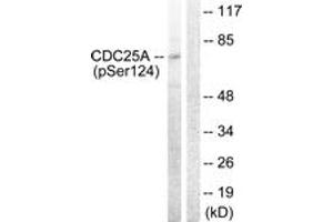 Western Blotting (WB) image for anti-Cell Division Cycle 25 Homolog A (S. Pombe) (CDC25A) (AA 90-139), (pSer124) antibody (ABIN1531550)
