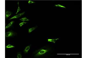 Immunofluorescence of monoclonal antibody to KHK on HeLa cell. (Ketohexokinase 抗体  (AA 1-298))
