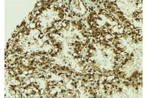 ABIN6279800 at 1/100 staining Human lung tissue by IHC-P. (SRPK2 抗体)