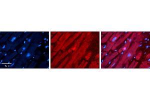 Rabbit Anti-TSG101 Antibody   Formalin Fixed Paraffin Embedded Tissue: Human heart Tissue Observed Staining: Cytoplasmic, nucleus Primary Antibody Concentration: 1:100 Other Working Concentrations: N/A Secondary Antibody: Donkey anti-Rabbit-Cy3 Secondary Antibody Concentration: 1:200 Magnification: 20X Exposure Time: 0. (TSG101 抗体  (N-Term))