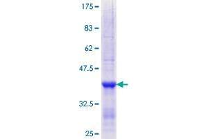 Image no. 1 for CD209 (CD209) (AA 271-380) protein (GST tag) (ABIN1348575)
