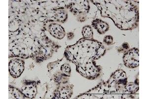 Image no. 1 for anti-Diacylglycerol Kinase, alpha 80kDa (DGKA) (AA 1-736) antibody (ABIN599366) (DGKA 抗体  (AA 1-736))