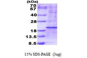 SDS-PAGE (SDS) image for Ribosomal Protein L35 (RPL35) (AA 1-123) protein (His tag) (ABIN5777754) (RPL35 Protein (AA 1-123) (His tag))