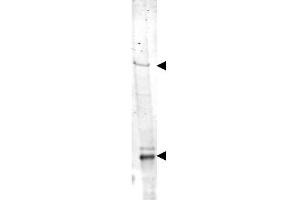 Image no. 1 for anti-Nipped-B like Protein (NIPBL) (AA 344-356) antibody (ABIN401167) (NIPBL 抗体  (AA 344-356))