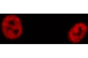 ABIN6274193 staining Hela cells by IF/ICC. (TFE3 抗体  (Internal Region))